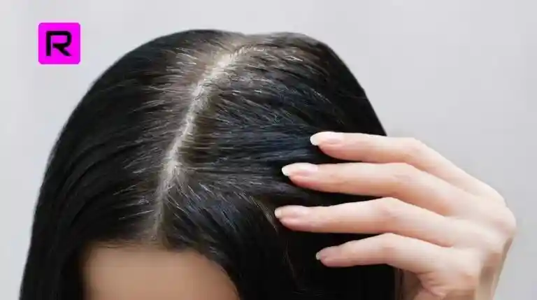 Best 14 Tips How To Reduce White Hair