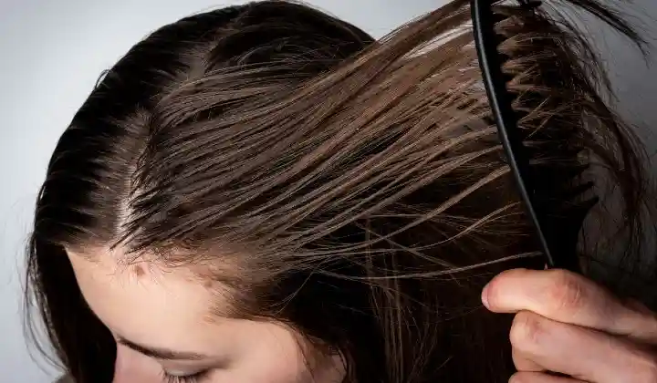 Oily scalp Hair