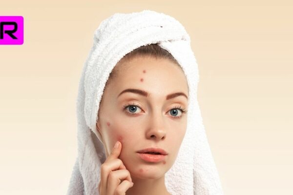 10 tips on how to remove dark spots from body