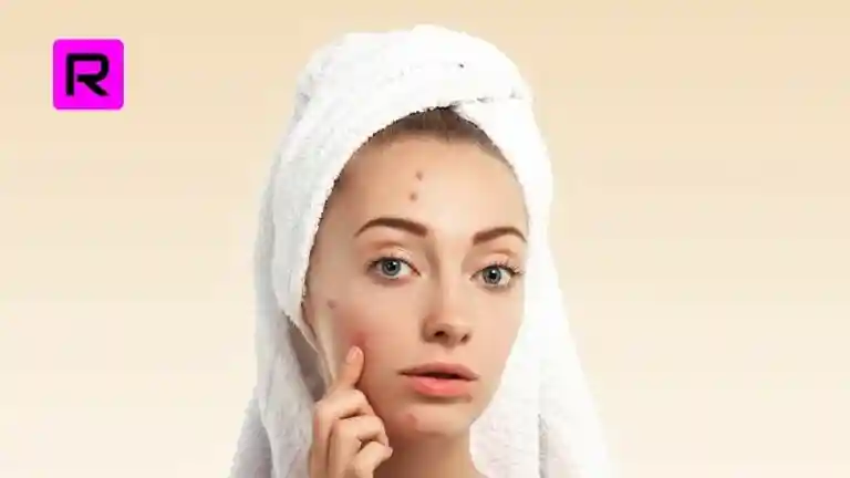 10 tips on how to remove dark spots from body