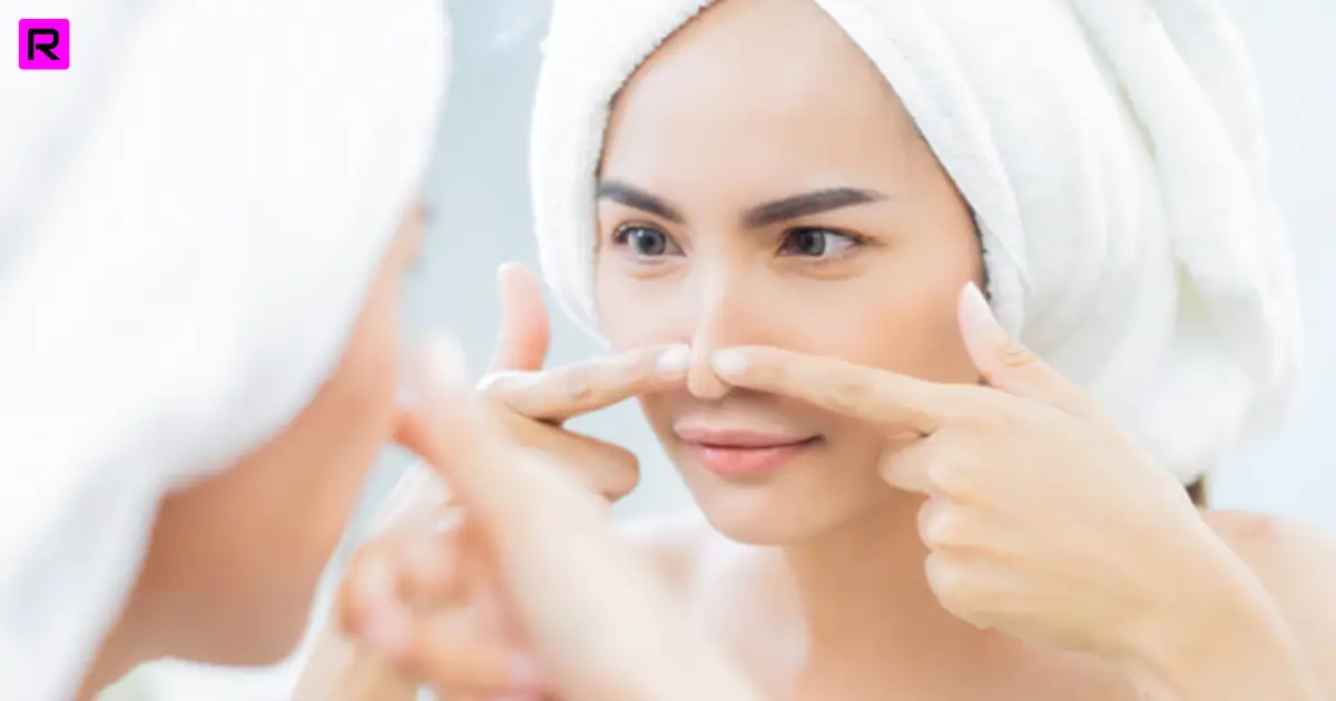 नाक के ब्लैकहेड्स हटाने के उपाय – How to Remove Blackheads on Nose